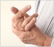 Arthritis treatment