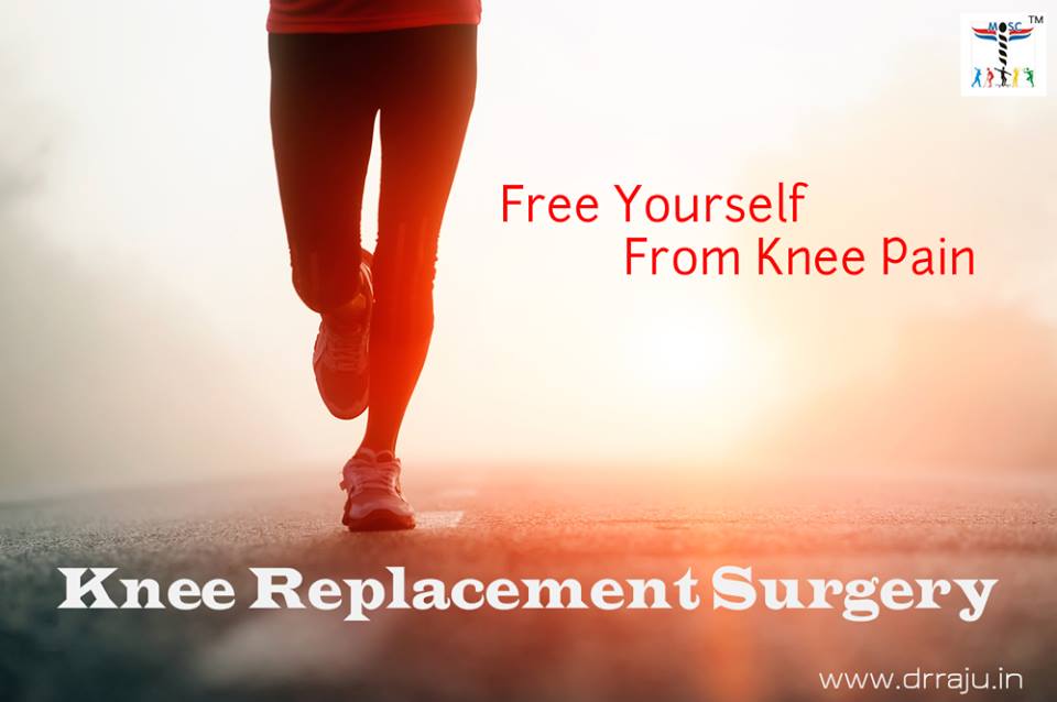 knee replacement surgery